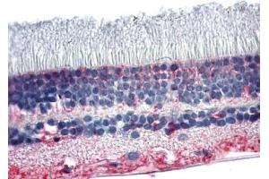 Immunohistochemical staining of Retina using anti- NR2E3 antibody ABIN122365
