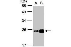 WB Image Sample(30 ug whole cell lysate) A:HeLa S3, B:Hep G2 , 12% SDS PAGE antibody diluted at 1:1000 (FABP6 antibody)