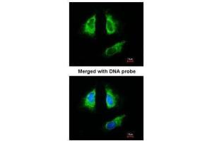 ICC/IF Image Immunofluorescence analysis of paraformaldehyde-fixed HeLa, using 14-3-3 beta , antibody at 1:200 dilution. (YWHAB antibody  (Center))