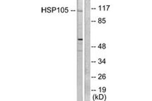 Western blot analysis of extracts from HeLa cells, using HSP105 Antibody. (HSPH1 antibody  (AA 791-840))
