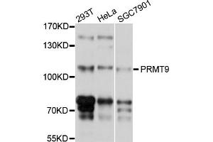 Western blot analysis of extracts of various cell lines, using PRMT9 antibody (ABIN5998612) at 1/1000 dilution.