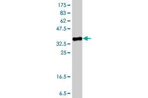 Western Blot detection against Immunogen (37 KDa) . (LCAT antibody  (AA 98-197))
