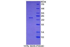 SDS-PAGE (SDS) image for Spondin 1 (SPON1) (AA 608-802) protein (His tag) (ABIN2122130)