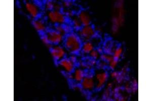 Expression of HCN3 in rat dorsal root ganglia (DRG) - Immunohistochemical staining of frozen section of rat DRG using Anti-HCN3 Antibody (ABIN7043281, ABIN7044972 and ABIN7044973), (1:50) followed by mouse anti-rabbit Alexa Fluor 555 (red). (HCN3 antibody  (Intracellular))