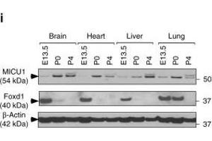 MICU1 is transcriptionally regulated by Foxd1 under hypoxia. (FOXD1 antibody  (C-Term))