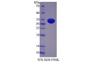 SDS-PAGE (SDS) image for Sciellin (SCEL) (AA 410-652) protein (His tag) (ABIN4989569)