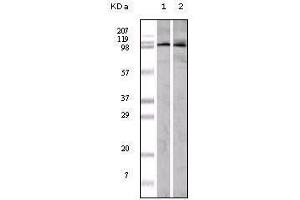 Western blot analysis using EphA1 mouse mAb against A549 (1) and Hela (2) cell lysate. (EPHA1 antibody)