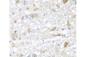 Immunohistochemistry of paraffin-embedded Rat brain using CBR4 Polyclonal Antibody at dilution of 1:100 (40x lens). (CBR4 antibody)