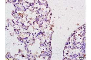 Formalin-fixed and paraffin embedded rat lung labeled with Anti-IL-22BP Polyclonal Antibody, Unconjugated (ABIN748193) at 1:200 followed by conjugation to the secondary antibody and DAB staining. (IL22RA2 antibody  (AA 165-263))