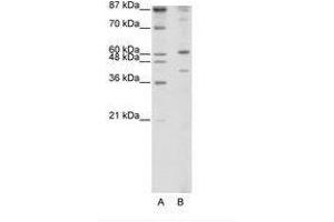 Image no. 1 for anti-REX4, RNA Exonuclease 4 Homolog (REXO4) (N-Term) antibody (ABIN202487) (REXO4 antibody  (N-Term))