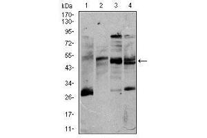 Image no. 4 for anti-CD5 (CD5) antibody (ABIN1491301)