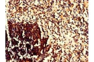 Immunohistochemistry of paraffin-embedded human spleen tissue using ABIN7145141 at dilution of 1:100 (CD79a antibody  (AA 70-142))