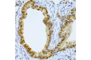 Immunohistochemistry of paraffin-embedded mouse lung using TAF1C Antibody (ABIN5974089) at dilution of 1/100 (40x lens). (TAF1C antibody)