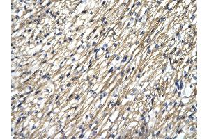 Rabbit Anti-STAT4 antibody Catalog Number: ARP33376  Paraffin Embedded Tissue: Human Heart cell Cellular Data: cardiac cell of renal tubule Antibody Concentration: 4. (STAT4 antibody  (N-Term))
