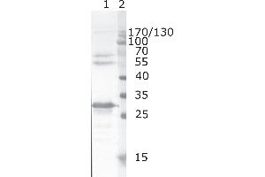 Western Blot testing of HIV-1 recombinant Nef protein. (HIV-1 Nef (AA 62-68) antibody)
