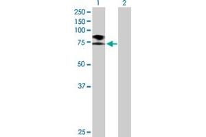 Western Blot analysis of SCNN1B expression in transfected 293T cell line by SCNN1B MaxPab polyclonal antibody. (SCNN1B antibody  (AA 1-640))