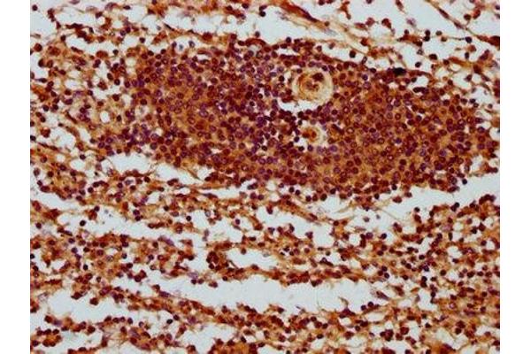 SH3BP1 antibody  (AA 161-266)