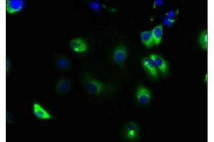Immunofluorescence staining of MCF-7 cells with ABIN7161298 at 1:133, counter-stained with DAPI. (NOTCH2 antibody  (AA 59-250))