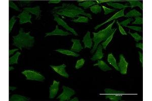 Immunofluorescence of monoclonal antibody to DFNB31 on HeLa cell. (DFNB31 antibody  (AA 808-907))