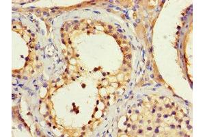 Immunohistochemistry (IHC) image for anti-Biogenesis of Lysosomal Organelles Complex-1, Subunit 1 (BLOC1S1) (AA 1-153) antibody (ABIN7145600)