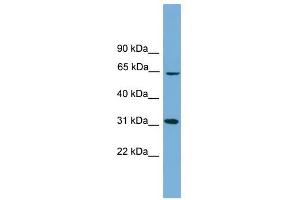 HSD17B11 antibody used at 1 ug/ml to detect target protein.