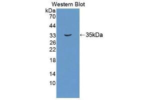 Western blot analysis of the recombinant protein. (UMPS antibody  (AA 205-480))