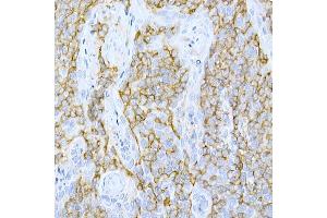 Immunohistochemistry of paraffin-embedded human tonsil using CD44 Rabbit pAb (ABIN6127601, ABIN6138192, ABIN6138194 and ABIN6213814) at dilution of 1:200 (40x lens). (CD44 antibody  (AA 346-385))