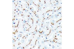 Immunohistochemistry of paraffin-embedded human liver using TGN46/TGOLN2 Rabbit mAb (ABIN7270875) at dilution of 1:100 (40x lens). (TGOLN2 antibody)