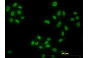 Immunofluorescence of monoclonal antibody to HDAC1 on HeLa cell. (HDAC1 antibody  (AA 1-482))