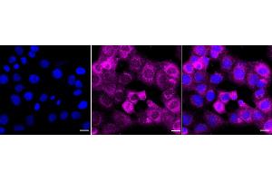 Immunocytochemical staining of HT- cells with NQO1 antibody (ABIN7800954), 1:1,000).