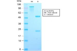 SDS-PAGE Analysis Purified TIMP2 Rabbit Recombinant Monoclonal Antibody (TIMP2/2488R). (Recombinant TIMP2 antibody  (N-Term))