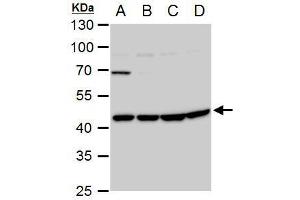 WB Image WNT11 antibody detects WNT11 protein by western blot analysis. (WNT11 antibody  (Center))