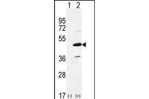 Western blot analysis of IRAK4 (arrow) using rabbit polyclonal IRAK4 Antibody (R20) (ABIN6243238 and ABIN6579012). (IRAK4 antibody  (N-Term))
