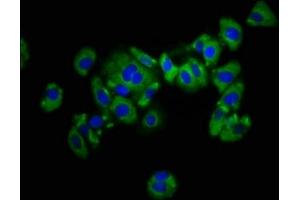 Immunofluorescence staining of HepG2 cells with ABIN7157495 at 1:133, counter-stained with DAPI. (KIR2DL1 antibody  (AA 162-267))