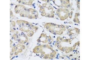 Immunohistochemistry of paraffin-embedded Human stomach using SCG3 Polyclonal Antibody at dilution of 1:100 (40x lens).