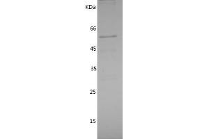 Western Blotting (WB) image for Interleukin-1 Receptor-Associated Kinase 2 (IRAK2) (AA 416-625) protein (GST tag) (ABIN7281774) (IRAK2 Protein (AA 416-625) (GST tag))