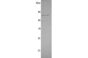 IRAK2 Protein (AA 416-625) (GST tag)