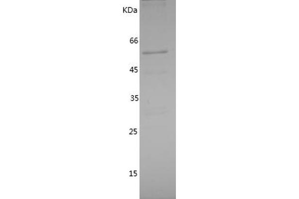 IRAK2 Protein (AA 416-625) (GST tag)
