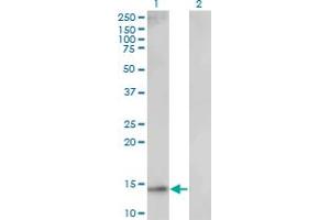 UBE2D1 antibody  (AA 1-94)