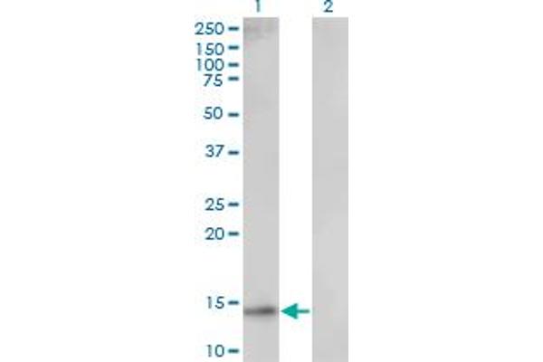 UBE2D1 antibody  (AA 1-94)