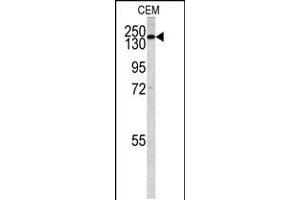 Western blot analysis of PI3KC2G antibody in CEM cell line lysates (35ug/lane) (PI3KC2G antibody  (N-Term))