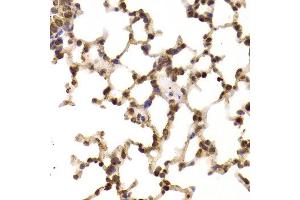 Immunohistochemistry of paraffin-embedded Rat lung using EIF5 antibody at dilution of 1:100 (x400 lens).