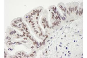 Immunohistochemistry (IHC) image for anti-Retinoblastoma Binding Protein 7 (RBBP7) (C-Term) antibody (ABIN7448758)
