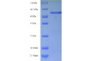 ampC Protein (AA 27-397) (His-SUMO Tag)