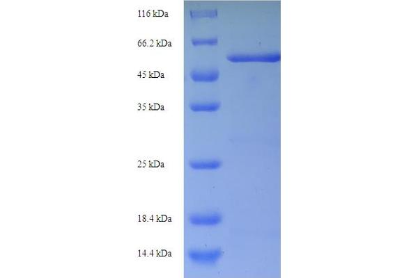 ampC Protein (AA 27-397) (His-SUMO Tag)
