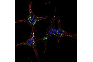 Fluorescent confocal image of HeLa cells stained with SYVN1 (HRD1) (C-term) antibody.
