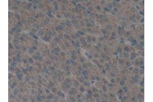 IHC-P analysis of Mouse Ovary Tissue, with DAB staining. (PLAU antibody  (AA 180-433))