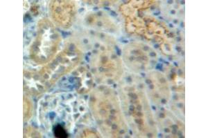 Used in DAB staining on fromalin fixed paraffin-embedded kidney tissue (CSTB antibody  (AA 2-98))