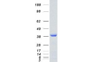 SET Nuclear Oncogene (SET) (Transcript Variant 2) protein (Myc-DYKDDDDK Tag)