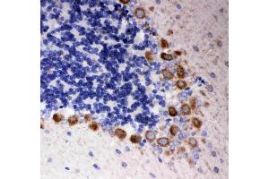 Anti- DISC1 antibody, IHC(P): Rat Cerebellum Tissue (DISC1 antibody  (Middle Region))